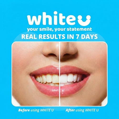 Image of Teeth Whitening Strips for Sensitive Teeth - Peroxide Free No Sensitivity - 14 Strips with Pap+ & Nano Hydroxyapatite - Enamel Safe Whitening in 7 Days - WhiteU