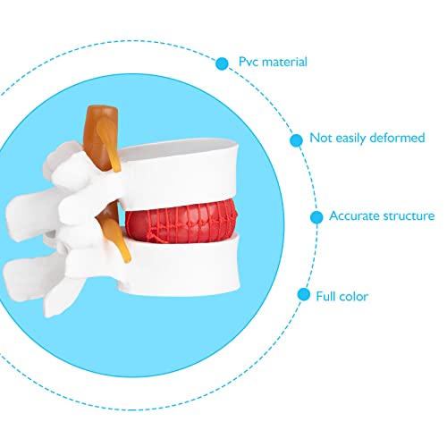 Image of ANNWAN Disc Herniation Model - Human Lumbar Disc Herniation Spine Model Vertebrae Disc Model for Teaching and Studying