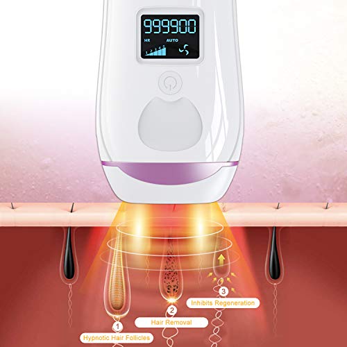 IPL Hair Removal for Women and Men, Permanent Painless Laser Hair Removal System, Upgrade to 999,900 Flashes, At-Home Hair Remover for Whole Body Use - Thumbnail 2