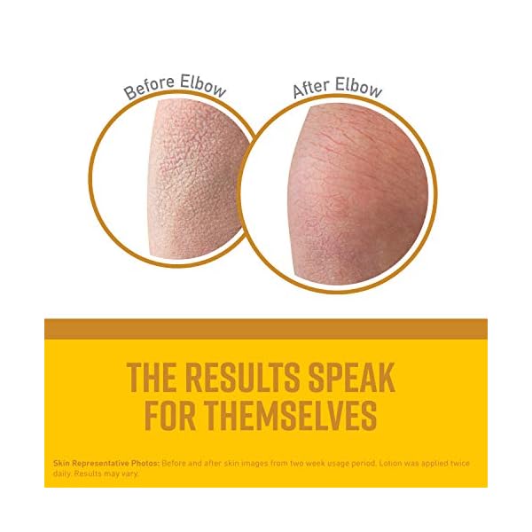 OKeeffes-Skin-Repair-Body-Lotion-and-Dry-Skin-Moisturizer-Pump-Bottle-12-ounce-Packaging-May-Vary O'Keeffe's Skin Repair Body Lotion, 12 Oz