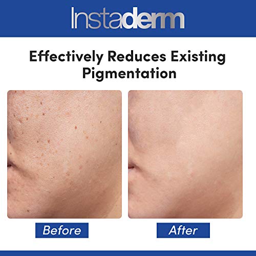 Dark Spot Corrector Serum- Reduces Dark Spots, Sun Spots, Age Spots, Acne Scars, & Freckles. Rejuvenates Texture & Tone With Anti-Aging Benefits. #TOP4