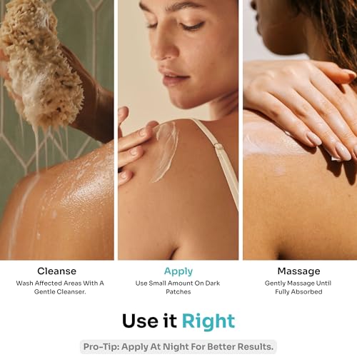 Image of Kitcoz Nigriclear Cream for Pigmentation (Acanthosis Nigricans) with Urea, Retinol & Lactic Acid | Treats Dark, Dry & Rough Skin Patches on Neck, Elbow, Knees, Armpits & Thighs | Diabetes Skin Care | Daily Use Safe - Men & Women (50gm)