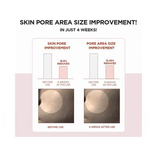Image of SKIN1004 Madagascar Centella Poremizing Fresh Ampoule | Soothing Hydration | Oily Combination Skin, 30ml