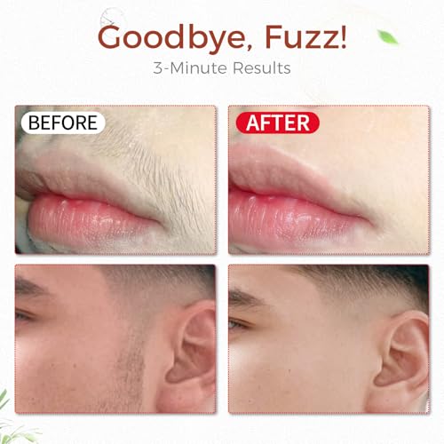 Image of Facial Hair Removal Cream for Women, Gentle Plant Formula for Sensitive Skin with Soothing Aloe Gel, 3 Min Painless Flawless Depilatory Cream Removes Hair from Chin, Upper Lip and Sideburns