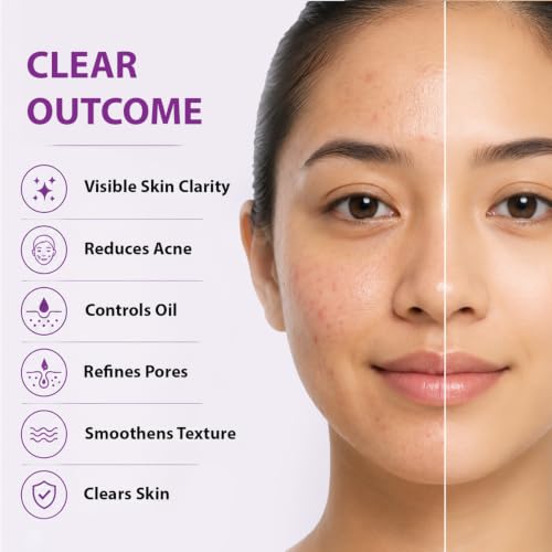 Image of Dermistry 2% Salicylic Acid 5% Niacinamide Zinc Spots Corrector Face Serum for Oily Acne Prone Skin Exfoliating Open Pores Oil Control & Removal Pimples Scar Marks Blemishes Men Women Boys Girls 30ml