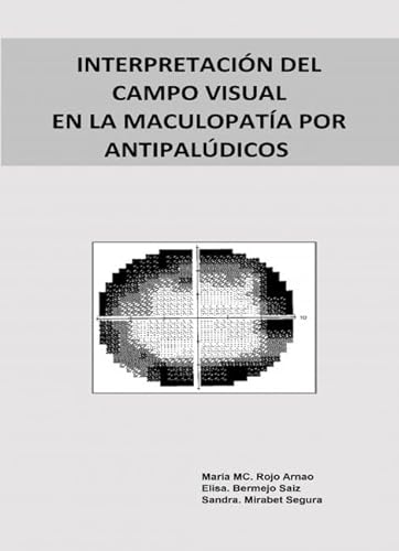 Interpretación del campo visual en la maculopatía