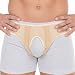 Vive Hernia Belt - Hernia Support Truss for Single/Double Inguinal or Sports Hernia - Two Removable Compression Pads & Adjustable Groin Straps - Surgery & Injury Recovery (Medium)