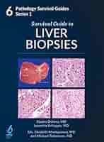 Survival Guide to Liver Biopsies: Kiyoko Oshima, MD, PhD