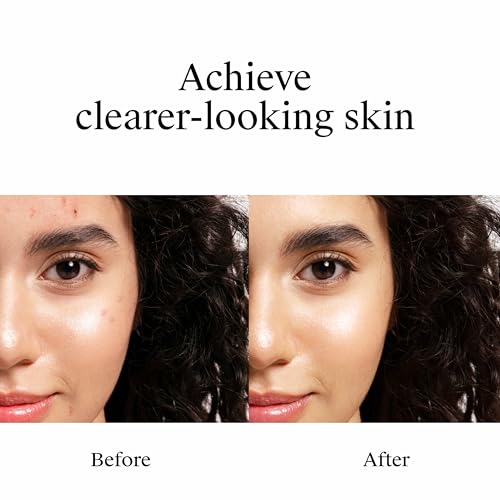 Neutrogena Rapid Clear Stubborn Acne Spot Treatment Gel, Maximum Strength 10% Benzoyl Peroxide Treatment Medication for Acne Prone Skin, Pimple Cream Reduces Size & Redness, 1 oz - Image 4