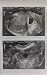 Prank 2D Customized Ultrasound SINGLE PHOTO ONLY