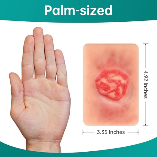 Image of Pressure Ulcer Wound Model Stage 3 Pocket Size
