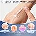 Rvlaim 100% Silicone Scar Gel Scar Cream, Advanced Silicone Gel for Removal of Surgical, Burns, Acne Scar, Old and Recent Scars and Stretch Marks, 1.7 oz/50ml