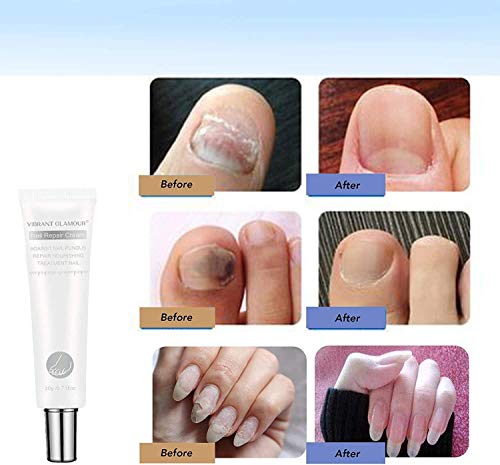 image for TTXS Vibrant Glamour Nail Care Nail Repair Cream Nail Fungus Treatment