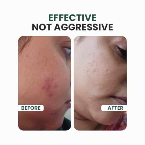 Image of Irresistible Double Defence Sunscreen | Sunscreen for Oily Skin SPF 50 PA++++ | No White Cast | Lightweight Non-Greasy Formula | Broad Spectrum & Blue Light Protection | Clinically Tested - (In-Vivo) - 50 ml