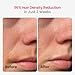 TRIPLE-Pulse IPL Laser Hair Removal, 12cm² Sapphire 37°F Ice-Cooling Contact, Hair Removal Device for Women and Men, Permanent Hair Removal at Home for Legs, Face, Bikini, Armpits, Trinity iGlow 10