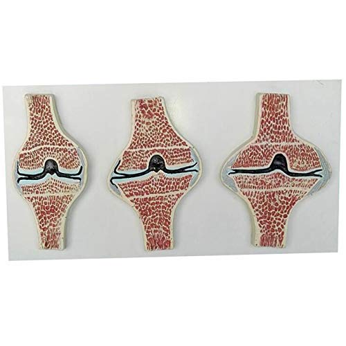 Buy Educational Model Knee Joint Sagittal Section Model Human Anatomy