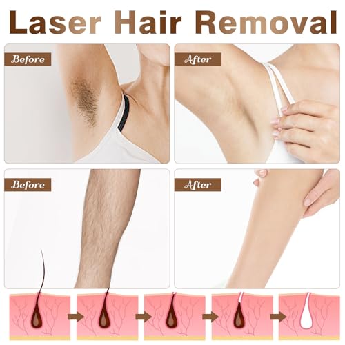 Laser Hair Removal for Women and Men, Permanent IPL Hair Removal Device with Latest Fast Flash Technology for Facial Legs Arms Hair Removal at Home Use