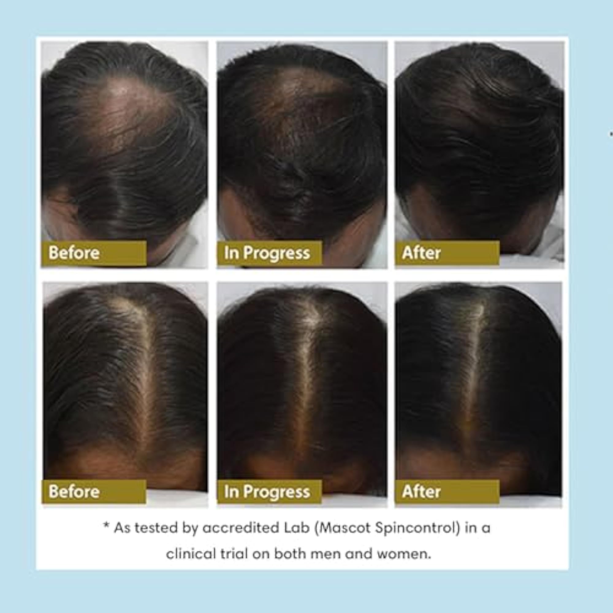 Hair Density Tonic for Hair Growth