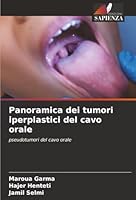 Panoramica dei tumori iperplastici del cavo orale (Italian Edition) 6200449295 Book Cover