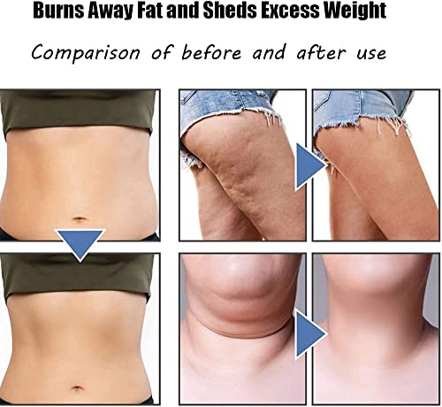 Finndeen 2023 Lymphatic Drainage Massager, Ems Neck Acupoints Lymphvity Massager Device, 12 Modes Neck Massager Portable Lymphatic Relief Neck Massager For Pain Relief Deep Tissue (1-Pc) #TOP5