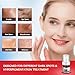 Dark Spot Remover for Face and Body - Dark Spot Corrector Serum for Acne Scars, Melasma, Age, Sun, Black Spots | Advanced Formula for Women and Men |Suitable for Oily, Dry and Combination Skin, 1.35FL