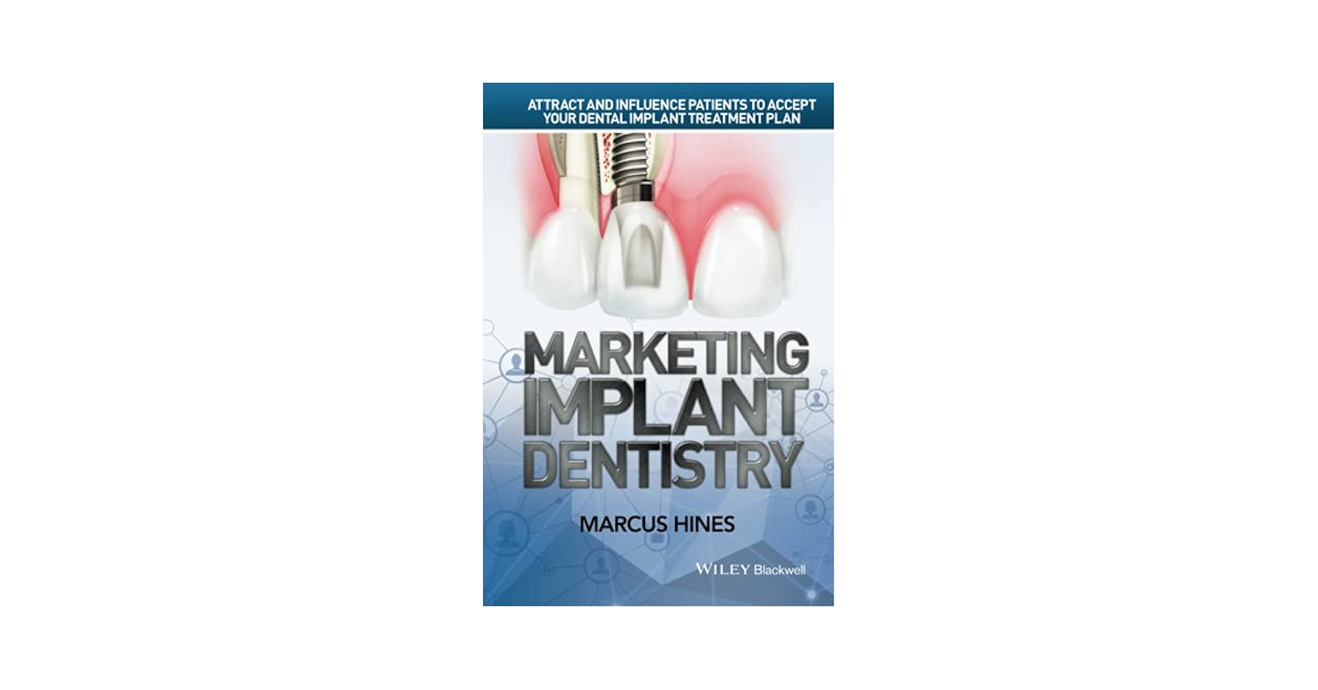 健康・医学 Implant Dentistry: Theory and Practice IMPLANT DENTISTRY THEORY AND PRACTICE (Dental Science