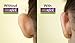 Otostick OTO Stick Ear Corrector Corrector Orejas 8 Units Ear Separation