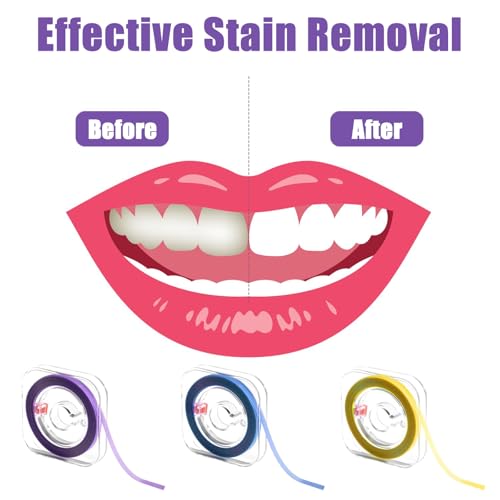 Zahn Schleifpapier, 3 PCS Zahnschleifpapier für Zahnzwischenräume Dentalschmirgelstreifen in 20μm 30μm 50μm zum Polieren und Reinigen Enger Zwischenräume
