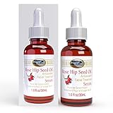 Sonoma Naturals Rose Hip Seed Oil Serum for Face, 1 oz | Anti Aging & Anti Wrinkle | Pore Minimizer | Skin Moisturizing & Brightening | Anti Oxidant Rich