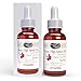 Sonoma Naturals Rose Hip Seed Oil Serum for Face, 1 oz | Anti Aging & Anti Wrinkle | Pore Minimizer | Skin Moisturizing & Brightening | Anti Oxidant Rich