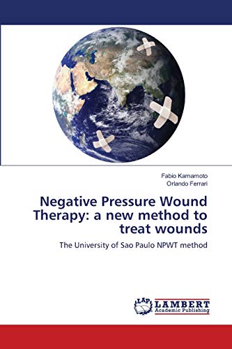 Negative Pressure Wound Therapy: A New Method To Treat Wounds #TOP11