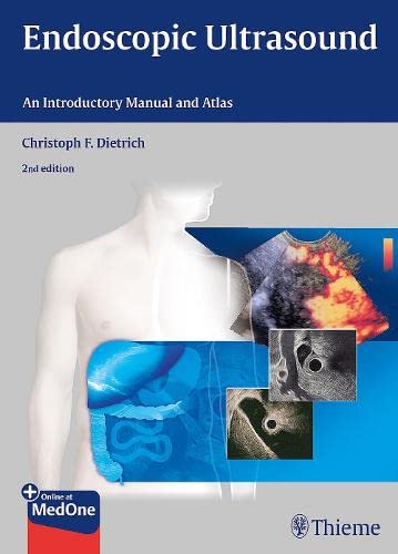 Endoscopic Ultrasound: An Introductory Manual and Atlas