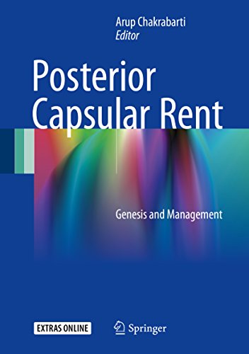 Posterior Capsular Rent: Genesis and Management (English Edition)