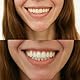 Smilebite – Farbkorrektor, White Bite Teeth Farbkorrekturserum – 30 ml Effektive Aufhellung und Farbkorrektur der Zähne Sichere Formel Professionelle Effekte Bleaching Whitening Zahnbleaching