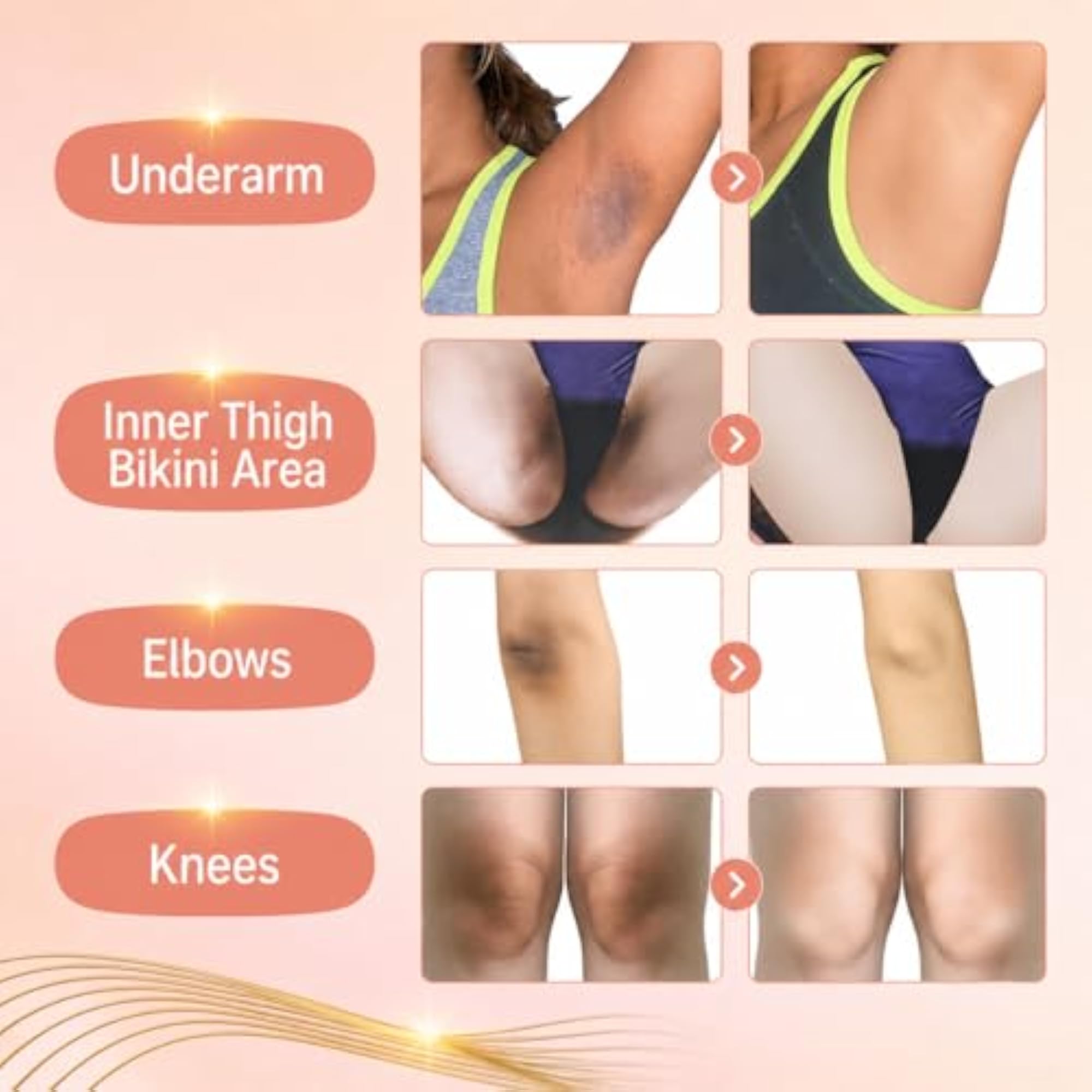 Natural Glow Kojic Cream for Skin Lightening