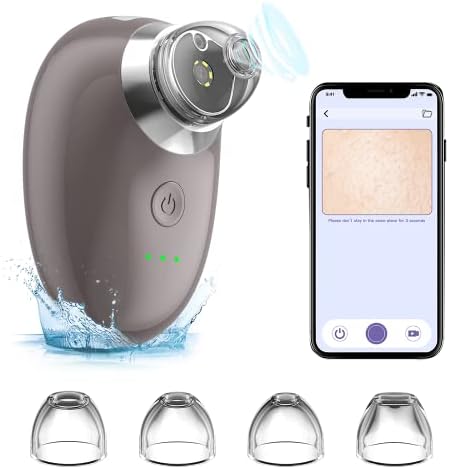 Blackhead Remover Pore Vacuum with Camera,WiFi Mini Visible Pimple Sucker Facial Cleaner Black Head Removal Tools,Pimple Acne Comedone Extractor with 4 Suction Heads