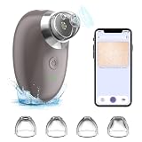 Blackhead Remover Pore Vacuum with Camera,WiFi Mini Visible Pimple Sucker Facial Cleaner Black Head