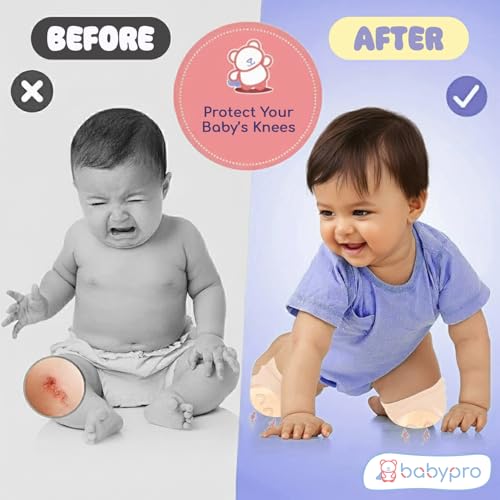 Image of BabyPro Baby Knee Guard-Set of 2, Multicolour Knee Pad for Toddler Crawling | Stretchable, Breathable Leg Warmers, Anti-Slip Silicone Knee Support