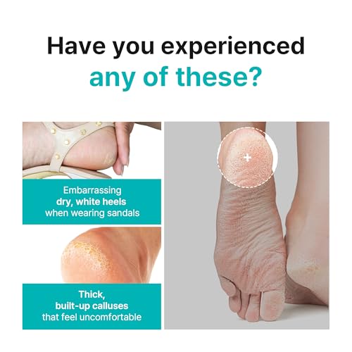 Image of Ariul Smooth & Pure Foot Peeling Mask (1 Pair) Korean Exfoliating Soothing Foot Mask Socks for Dead Skin & Callus Removal, AHA BHA Foot Peel Treatment for Dry Cracked Feet, Soft Smooth Foot Care Mask (Aloe Vera)