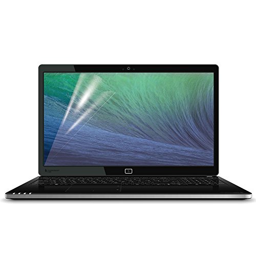 COOSKIN® Anti-Glare(Matte) Fingerprint Scratch Laptop LCD Screen Protector for 17.3 Inch Laptop 382.5mmx214.5mm-Retail Packing