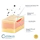 Cutiderm Hydrokolloid Extra Dünn Wundauflagen, steril, 10 x 10 cm, 10 Stück