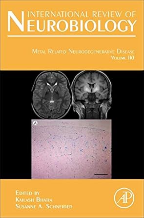 Metal Related Neurodegenerative Disease