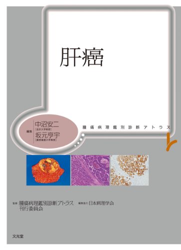 無料電子書籍 pdf 肝癌 (腫瘍病理鑑別診断アトラス) バイ