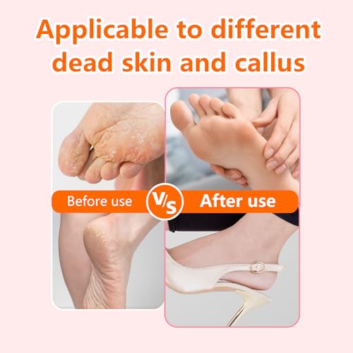 Electric Foot File Remover Callus, Professional Adjustable Speed Foot File Grinder with 60pcs Replacement Sandpaper Disks for Men & Women - for Dead Skin, Calluses, Dry & Cracked Feet (Gold)