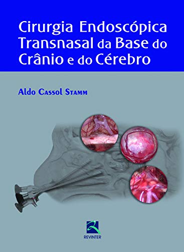 Cirurgia Endoscópica Transnasal da Base do Crânio