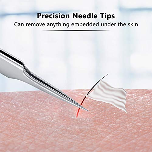 3 Pieces Ingrown Hair Tweezers Stainless Steel Splinter Tweezers Pointed Blackhead Remover Precision Eyebrow Tweezers For Facial Hair, Ingrown Hair, Splinter And Blackhead Remover (Silver) #TOP1