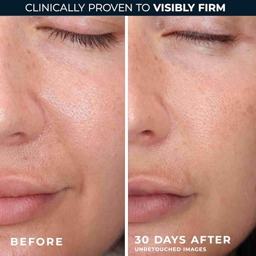 RoC 35 Protocol 5-Piece Complete Anti-Aging Skincare Routine Kit with Retinol Serum, SPF 30 Moisturizer, Eye Cream, & Firming Stick for Visible Wrinkle Reduction and Skin - image 4