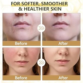 Veakoo Beef Tallow for Skin, Organic Whipped Tallow and Honey Balm, Grass Fed Beef Tallow Face Moisturizer, Natural Tallow Skin Care Cream Body Butter, Nourish and Soothe Dry Skin