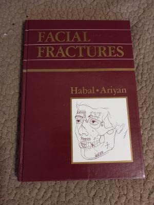Facial Fractures