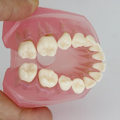 Dental Implant Teeth Model Study Teach Standard Model With Removable Teeth #TOP5